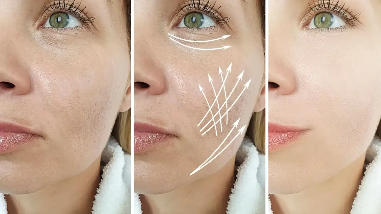 Can One Treatment Really Tackle More Than One Skin Concern Bellshill?