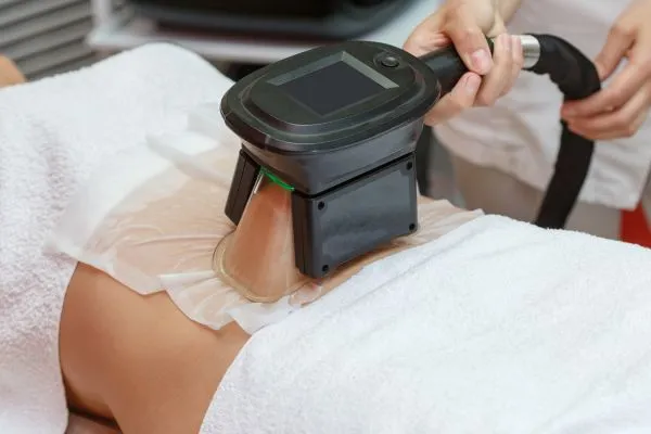 Image of person having fat freezing treatment to help weight gain Bellshill