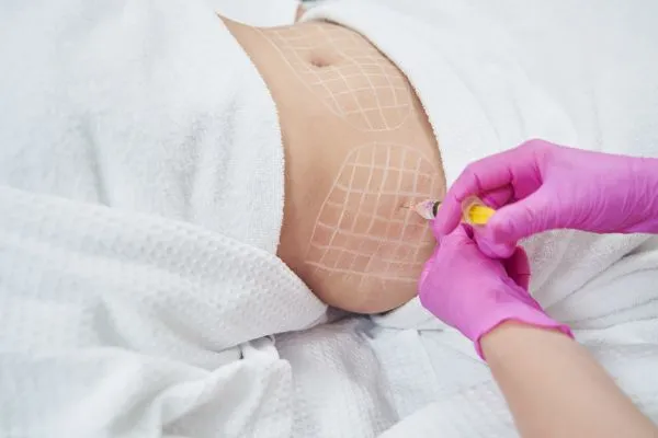 image of fat dissolving injections on love handles to help combat weight gain Bellshill
