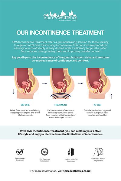 image to show how EMS treatment works for female urinary incontinence Bellshill