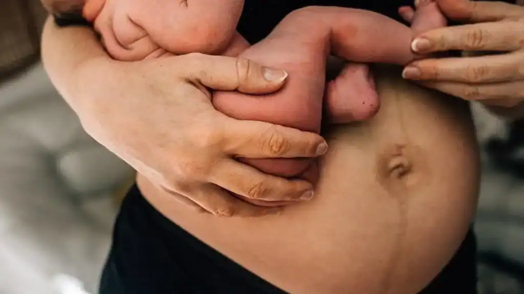 Why Is My Stomach Still Big After Pregnancy Bellshill?